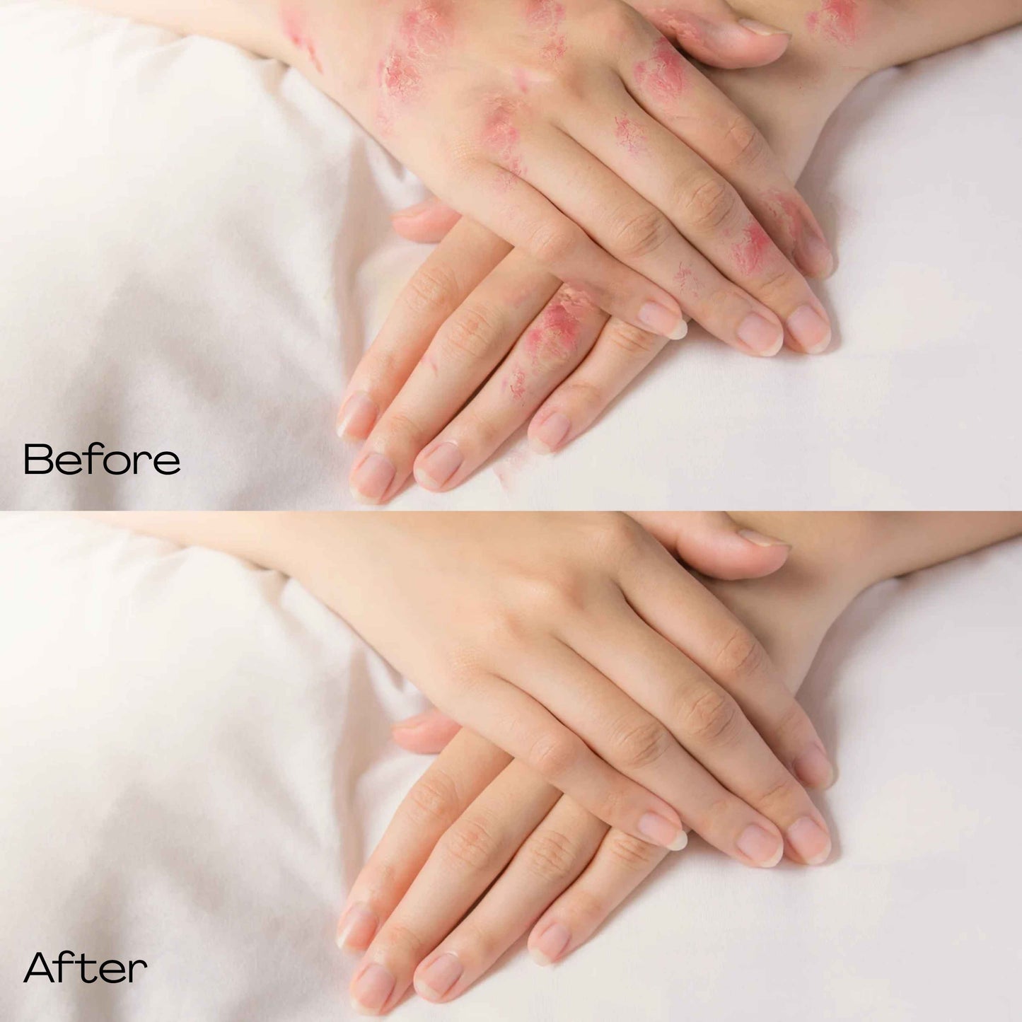 Derma Herb Skin Relief Cream