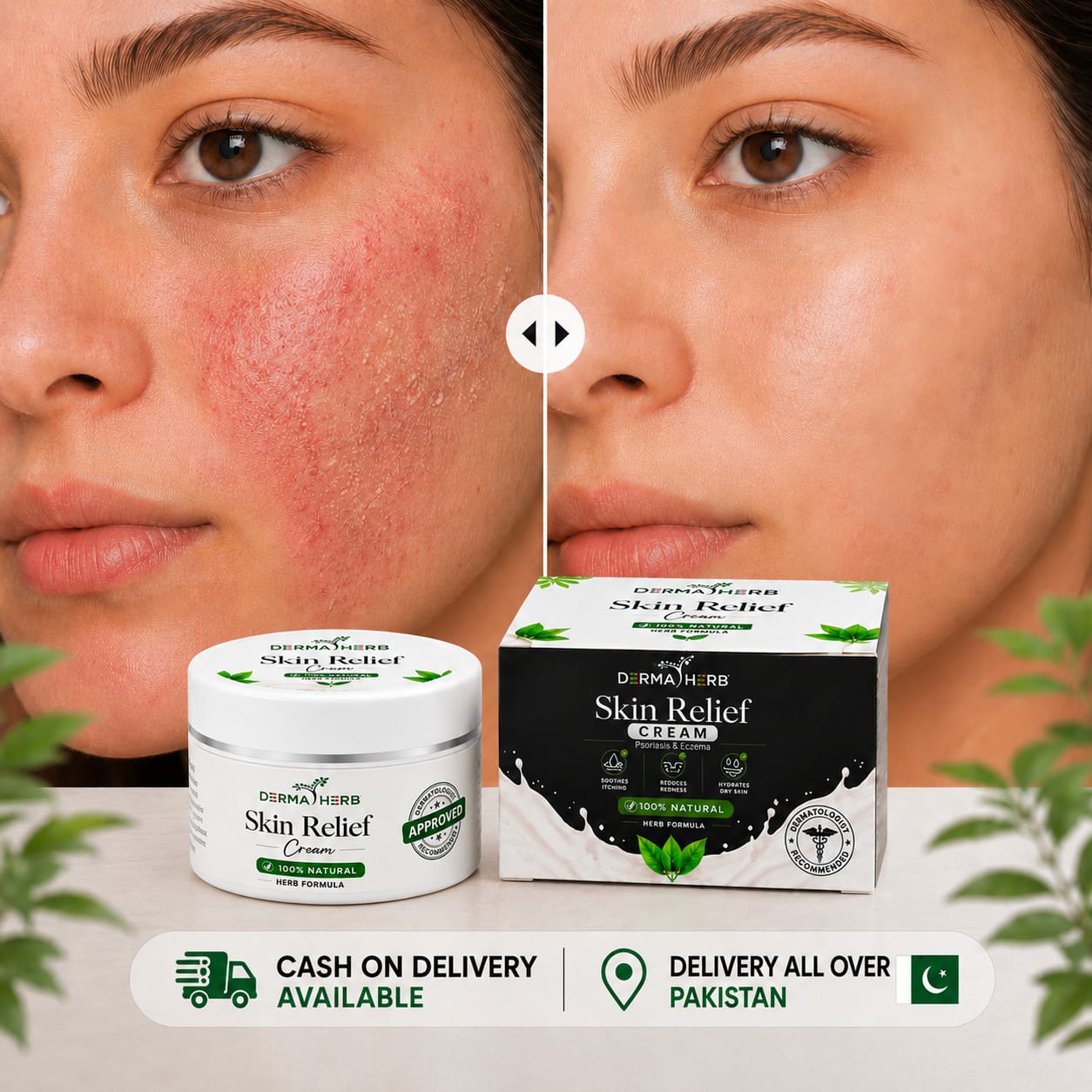 Derma Herb Skin Relief Cream